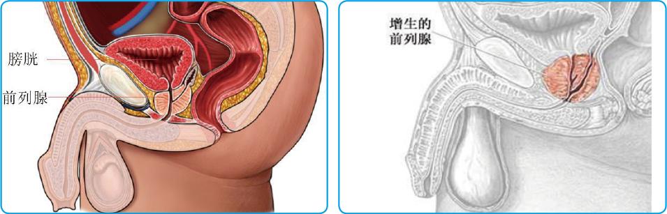 男科守护男性健康，幸福生活从此起航